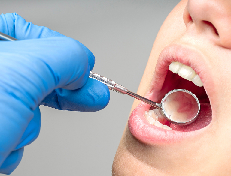 Understanding the Value of Dental Implants