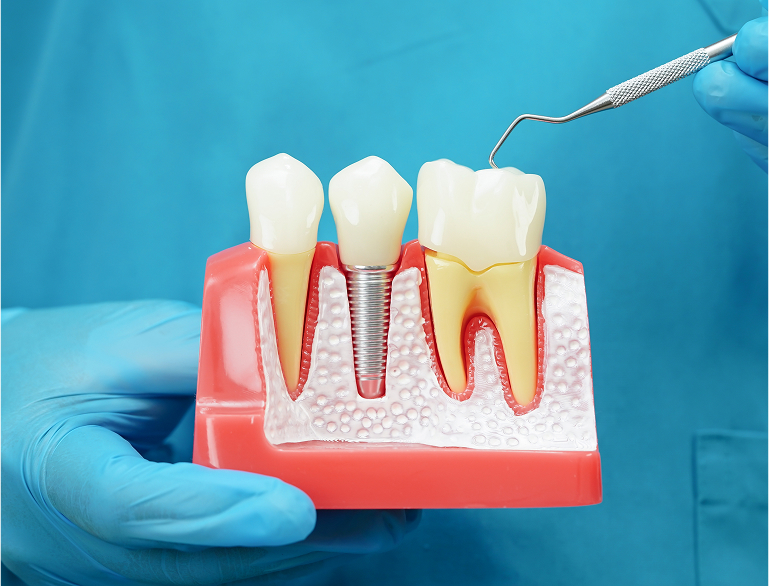 Advanced Technology for Precision Care